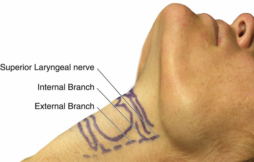 laryngeal-nerve