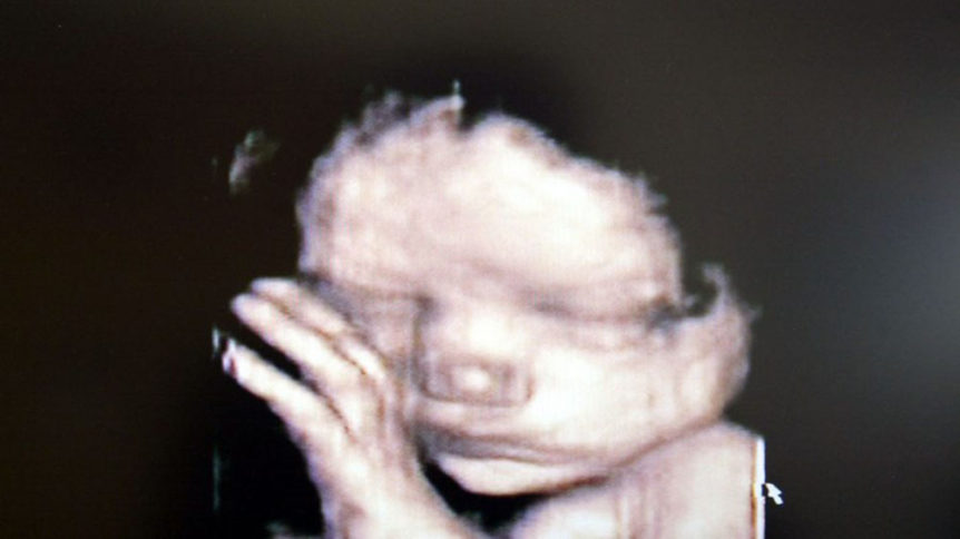 baby-in-ultrasound