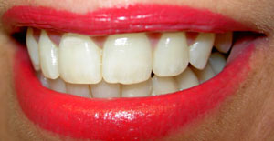 row-of-teeth